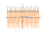 Производная sqrt(1+sin(6*x)^(2))